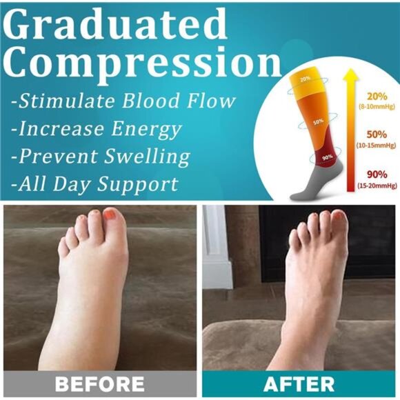 6 Pack Copper Compression Socks for Women and Men Circulation-Best Support - Picture 4 of 8